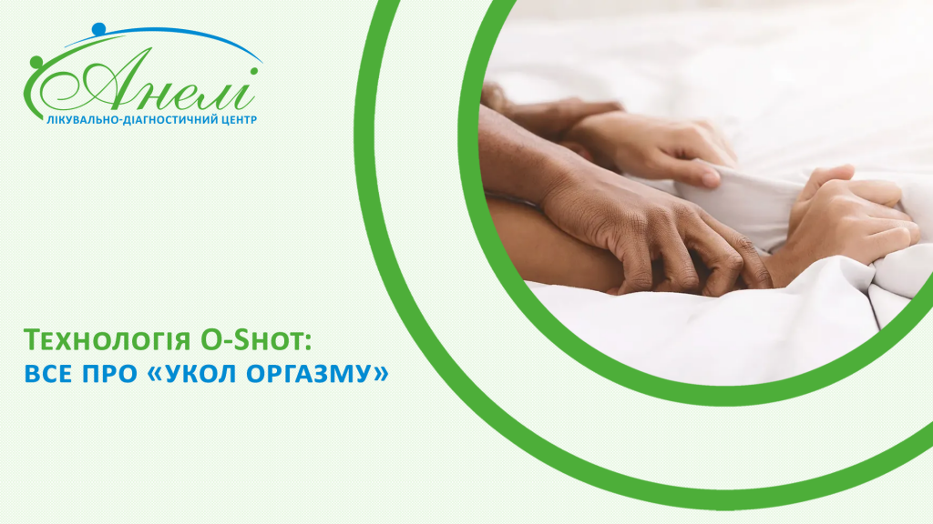 Технологія O-Shot